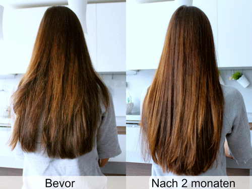 Hairjazz Shampoo Kann Das Wachstum Ihres Haares Beschleunigen